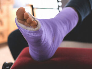 Broken Ankle? Here’s How to Walk Again