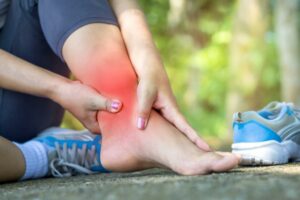 What Are Ankle Sprains?