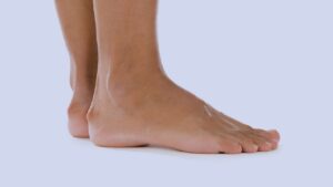6 Reasons You Might Have a Heel Bump and What to Do About It
