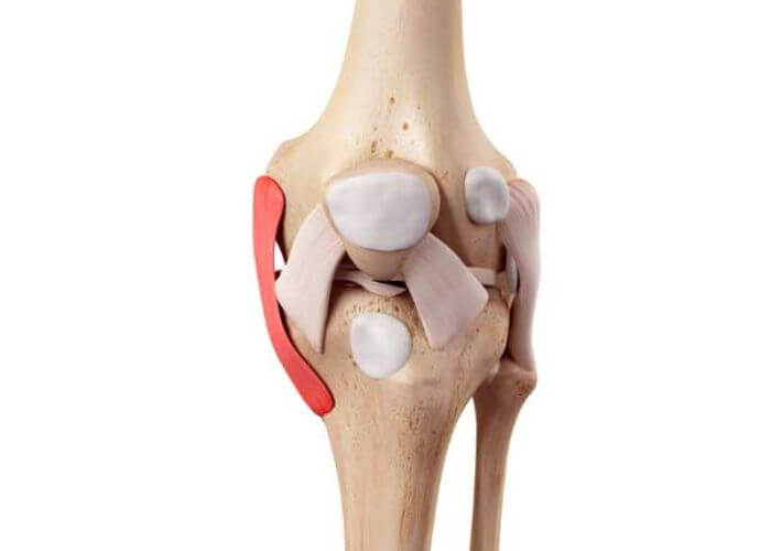 MPFL (Medial Patellofemoral Ligament) Treatment And Tips