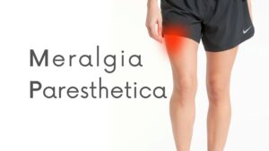 What Is Meralgia Paresthetica?