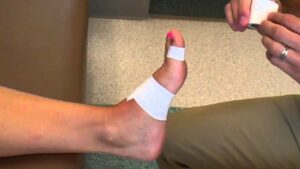 Pain relief