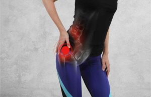 What is a Labral Tear in the Hip?