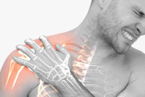 What Is AC Joint Pain?