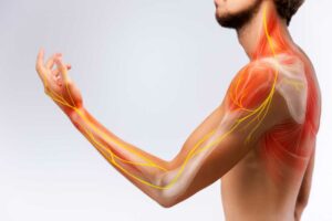 What Type Of Physical therapy Is Used In Complex Regional Pain Syndrome?