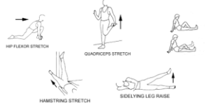 How Is Snapping Hip Syndrome Treated?