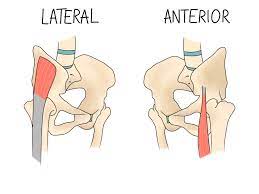 What Is Snapping Hip Syndrome?
