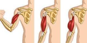What Is Torn Bicep Tendon?