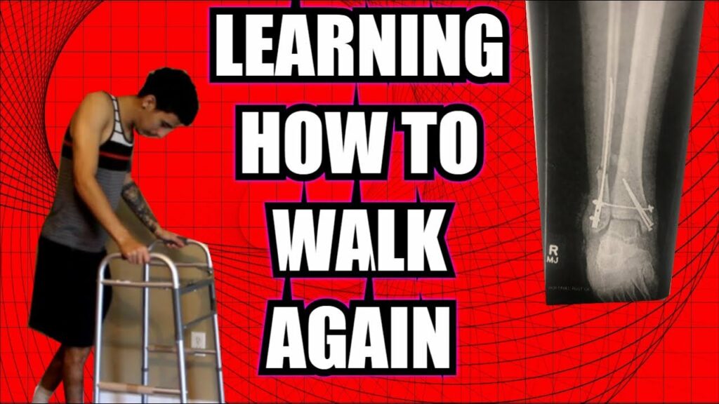 Can You Still Walk On A Broken Ankle