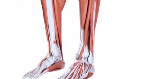 What Are the Causes of Medial Tibial Stress Syndrome?