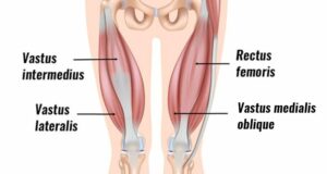 VMO Muscle: What It Is and Why You Need It