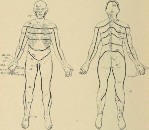Lumbar Radiculitis Symptoms, Causes and Treatment