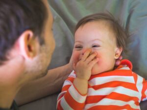 What Is Down Syndrome?