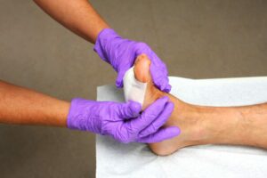 What Type Of Physical Therapy Is used For Wound Care?