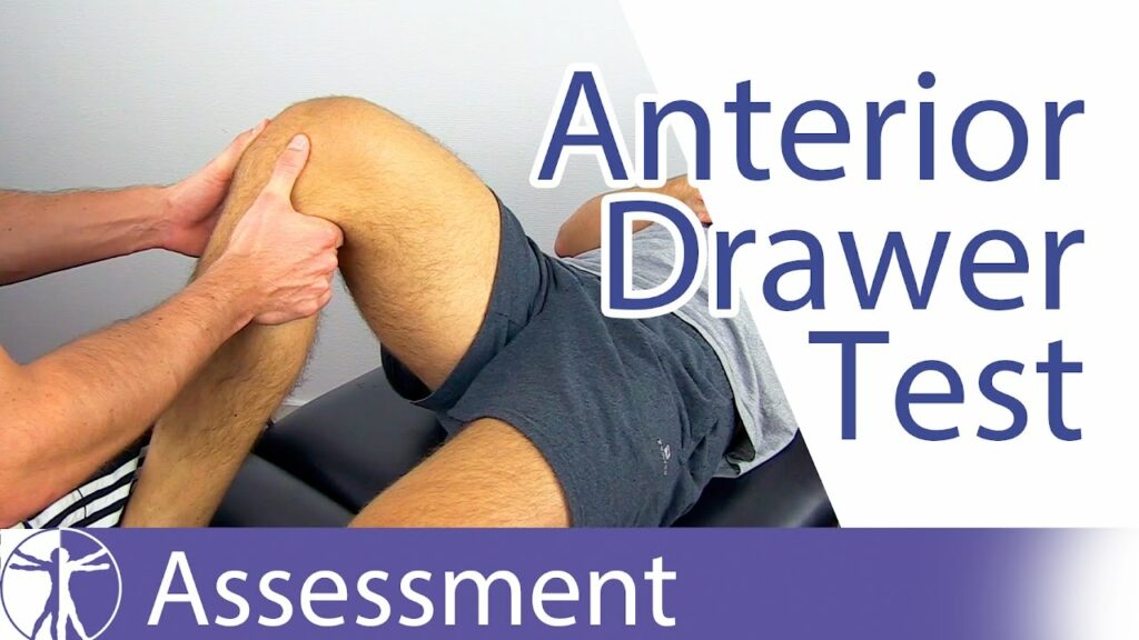 Anterior Drawer Test | Elements of Anterior Drawer Test