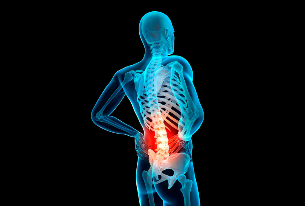 Causes of Low-Back Pain