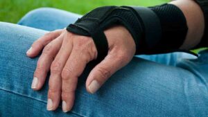 How Physical Therapy For Rheumatoid Arthritis Works