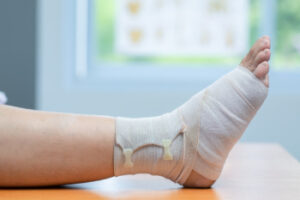 How To Select From Types of Stress Fracture Treatment?