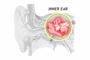 What Is Inner Ear Trauma?