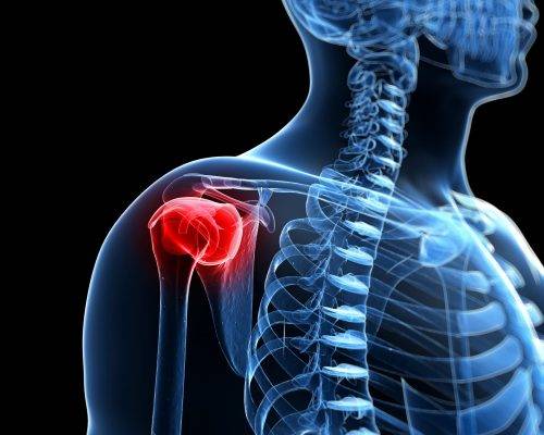 Labrum Tear: Comprehensive Guide To This Problem