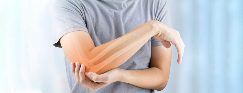 Physical Therapy Guide to Pitcher's Elbow