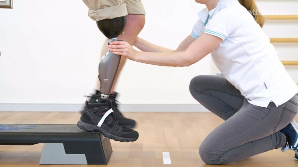 Phantom Limb Pain | Physical Therapy For Phantom Limb Pain