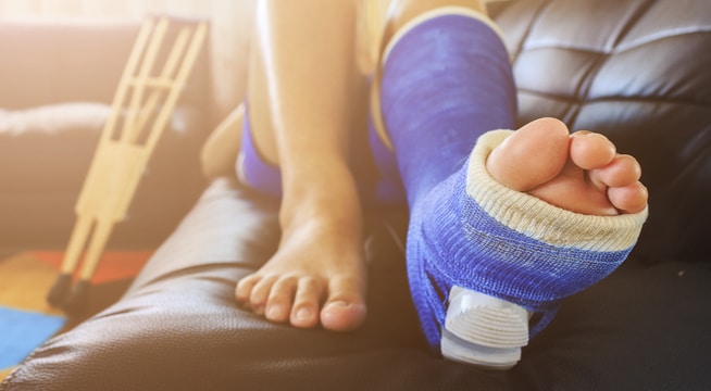 Types of Stress Fracture Treatment