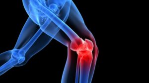 What Are Knee Injuries?