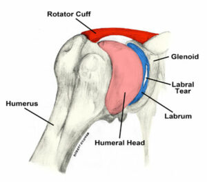 What Are Labrum Tears?