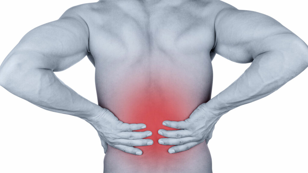 What Is Low-Back Pain?