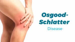 What Is Osgood-Schlatter Disease?