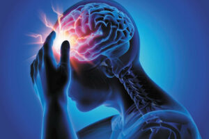 What Is Traumatic Brain Injury?