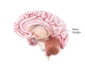 What is Parkinson’s Disease?