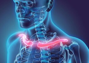 clavicle pain