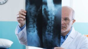 Arthritis In The Back Diagnosed