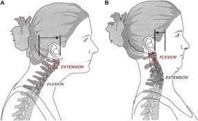 Chin tucks