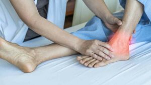 How To Treat Tarsal Tunnel Syndrome