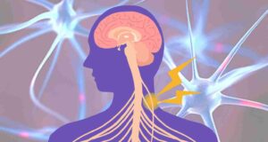 Side Effects Of Vagus Nerve Stimulation