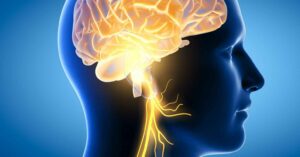 What Is Vagus Nerve Stimulation?