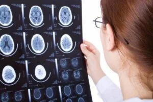 Roles and Responsibilities of Neurological Psychologists