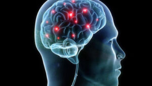 Does Neurostimulation Work For Depression?